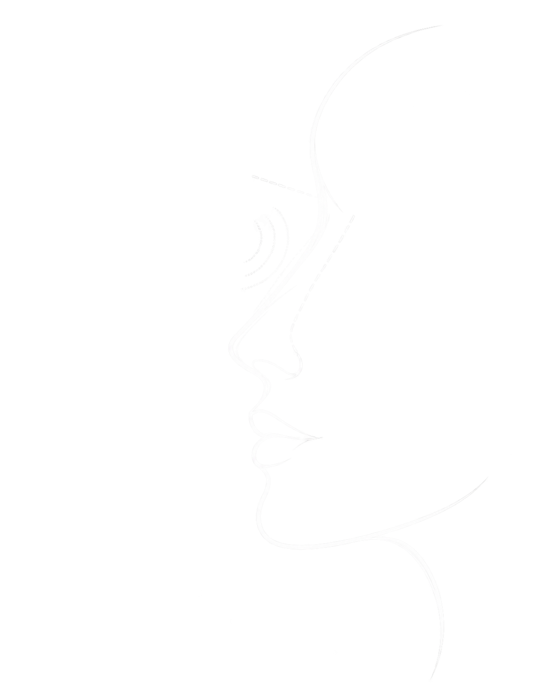 Ilustración médica de rinoplastia ultrasónica y planificación del trabajo óseo