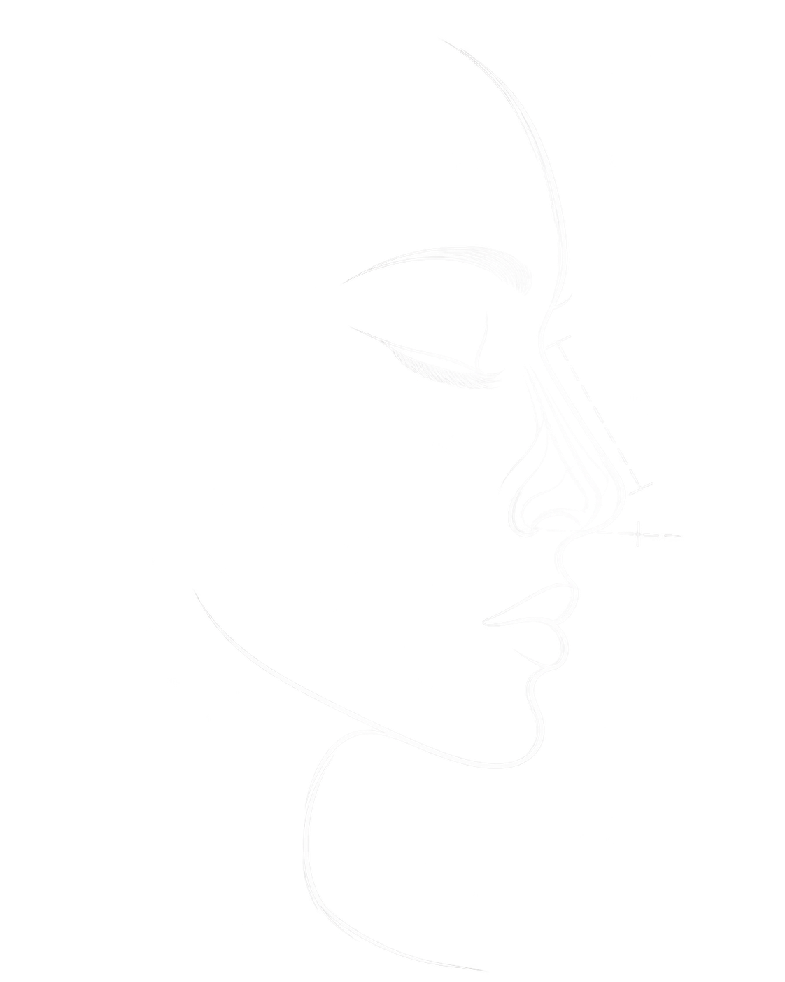 Ilustración médica en línea del perfil nasal para explicar una septoplastia